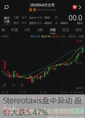 Stereotaxis盘中异动 股价大跌5.47%